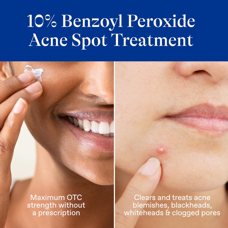 Differin Acne Spot Treatment with 10% Benzoyl Peroxide, Maximum Strength OTC Acne Treatment, Fast Acting Spot Treatment for Face, 1 oz - Image 3